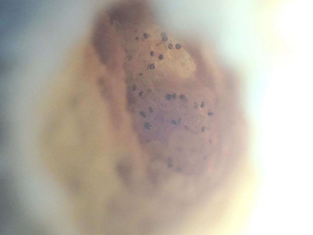 江の浦のアナハゼの卵